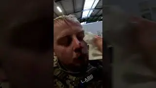 Airsoft INJURY - BB almost stuck in the face