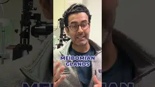 Doctor Explains Meibomian Glands + Dry Eye 👨🏽&zwj;⚕️💡