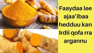 Faydaa lee dinqisiifamoo hedduu kan irdii  qofarraa  argamu 👈👍