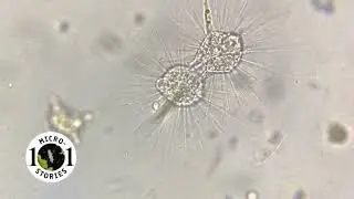 Heliozoa undergoing cell division