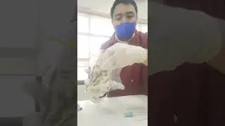 Bread Mold Observation Under the Microscope