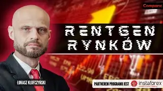 USA na tykającej bombie | Rentgen Rynk&oacute;w #80