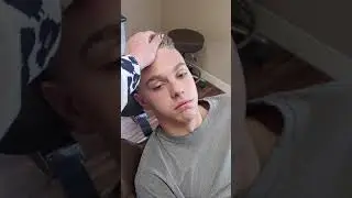 Chase waking up after wisdom tooth removal