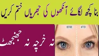 How To Remove Wrinkles Under Eyes|How To Get Rid Of Under Eye Wrinkles|Eye Wrinkle