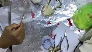 Laboratory of removable partial denture clasp