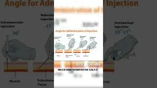 Angles of Administration of Injection - ID, IM, SC, IV#administration #injection #shortvideo