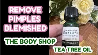 The Body Shop Tea Tree Oil Review | How to  Remove Acne, pimples|| The Body shop