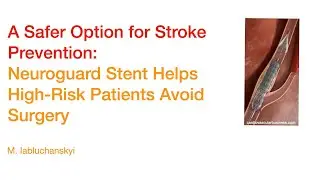 A Safer Option for Stroke Prevention: Neuroguard Stent Helps High-Risk Patients Avoid Surgery