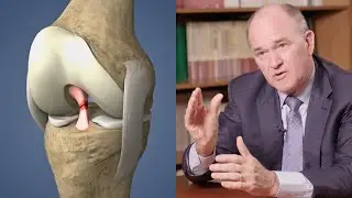 Why women tear their ACL more than men - Daniel Cooper, MD