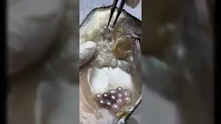 Pearl Clam Opening Real Freshwater Pearl Oyster Extraction, Demon Pot Pearls Clam
