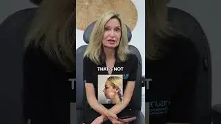 Chin filler gone wrong? Physician reacts!           #botched #botox #swelling #shorts