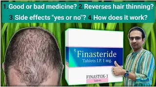 how does tablet finasteride work for hair loss? | finasteride tablet uses in hindi | finasteride