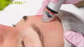 ГИДРОПИЛИНГ HYDRAFACIAL MD &ndash; Инновационная методика для очищения и увлажнения кожи
