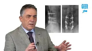 Xlif | Dr. Angel Hidalgo Ovejero