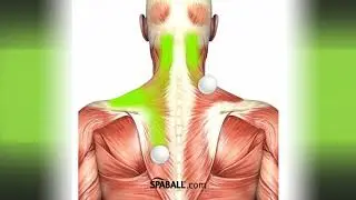 What Are Trigger Points?