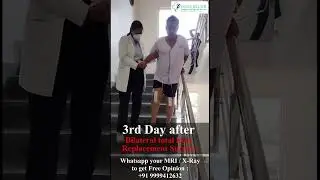 Bilateral Knee Replacement Surgery के अगले ही दिन चलना शुरू | Painless Surgery & go home in 3 days.