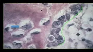 Learning Bone Growth 2: The Osteoblast and Woven Bone Formation (2020)