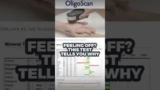 No blood. Just fast data on minerals + metals. Fix fatigue. DM &ldquo;CEA&rdquo; now. #DocQ #CEA #OligoScan
