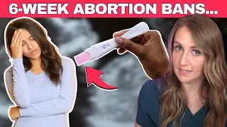 Do 6-week abortion bans actually work? Doctor explains...