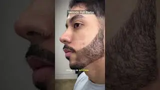 Melhor forma de preencher a falha da barba? #metodofullbarba #preenchimentodebarba #minoxidil