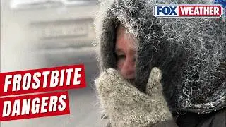 Doctor Details Dangers Of Frostbite As Extreme Cold From Arctic Air, Polar Vortex Threatens Millions