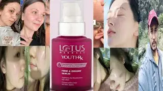 Lotus Herbals YouthRx Firm Bright Serum | Honest Review In Hindi