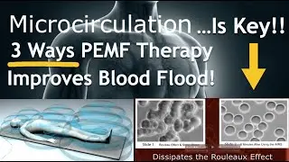 The KEY to PEMF Therapy: Improved Microcirculation (Works in THREE WAYS!!)