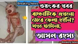 rampur hat hospital baby news |Tufanganj dangerous baby is born |তুফানগঞ্জ হাসপাতালে জন্ম আজব বাচ্চা