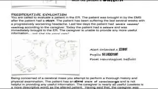 MDandBeyond: Cerebral Mass: Preoperative Concerns