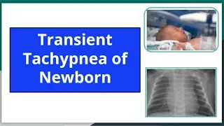 Transient tachypnea of newborn #mbbs #newborn#neonatology #neetpg #pediatrics #nursing #ttn #