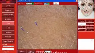 Intelligent skin analysis system (GBS-1800)