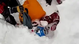 Man Shoveled Out After Being Buried Alive by Avalanche