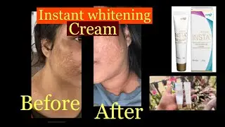 Fair Insta Best skin whitening cream || Glowing skin || Melasma bhi kam kare || instant results ||