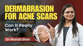 Dermabrasion: Acne Scars के लिए Effective? | Benefits, Procedure, and Results | Clear Skin, Pune