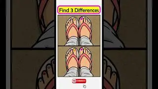 Part 26 🧠 Find 3 Differences 👀 | Brain Test #Shorts