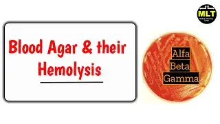 Blood agar and Hemolysis Test | Types of hemolysis on blood agar