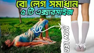 Fix Bow Legs Naturally at Home | 5 Proven Exercises for Leg Alignment (No Equipment!)