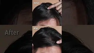 Loreal Paris magic Retouch #greyhair #hairspray #lorealparis #beforeandafter #shortsfeed