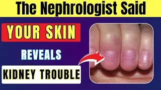 7 Hidden Skin Symptoms That Reveal Early Diabetic Kidney Trouble