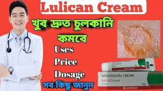 Lulican cream full review in bangla, uses, price, dosage