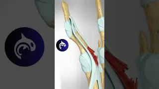 See what a Boutonni&egrave;re Deformity looks like in 3D #3danimation