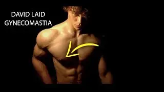 David Laid And Gynecomastia - Steroids Or Bad Lighting?