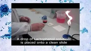 LPCB (lacto phenol cotton blue mounts )mycology صبغه قطن زرقاء-علم الفطريات