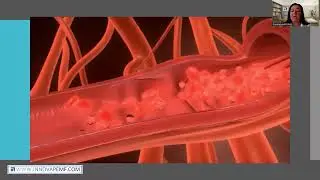 Magnetoterapia PEMF di iMRS PRIME e OMNIUM1