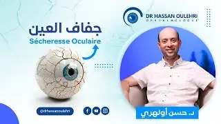 علاج جفاف العين بتقنية IPL: الحل المبتكر لصحة عينيك! .. الدكتور حسن أولهري