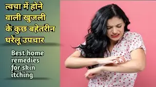 Best home remedies for skin itching in Hindi | #homeremedies | #skinitching | medhealth support
