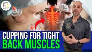 Cupping for tight back muscles