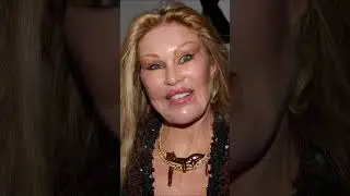 10 Worst Celebrity Plastic Surgery Fails That Shocked the World 😱  Part 1