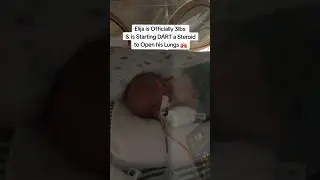 Micro Preemie Baby Journey #nicu #preemiebaby #nicubaby #micropreemie #preemies