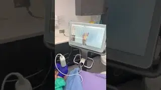 Intraoral 3D scanning of teeth. Power of digital technology with itero scanner.